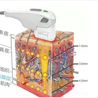 ��������Ч�������м�Ƥ������������������~