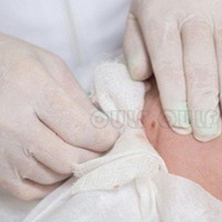 �ߵ�ȧ�Ǳ��ʲôʱ����Իָ����ߵ��������ʲôʱ���ָܻ�~