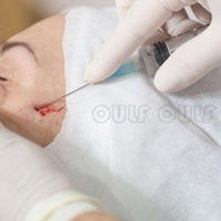 ȫ������ߵ��沿������ô�����ߵ��沿�����и�������~