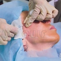 զ���£��ߵ�20��������а��ݣ��沿�ߵ���ʲôʱ��ָ���