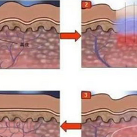 ѡ�����ѣ������������꼪��������ʲô�������������꼪����~