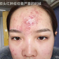 ��¼����--����Ů��ȥ��ʷ