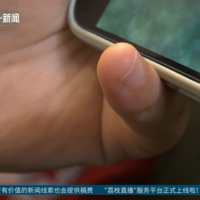 �����СĴָ��ס�ֻ�����������ҽ�����ѣ�