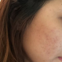 �������Ѹ���βݹ����۷�����ʵЧ����Σ�