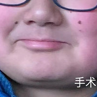 ��¼С����������ҽԺ����Ĺ���