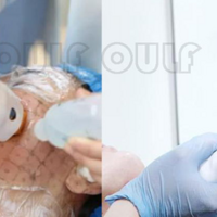 �����꼪���������ָܻ��������������꼪�Ժ�Ҫע��ʲô