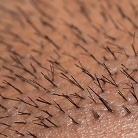 ֲ������ָ�Ҫע��ʲô��ë����ֲ����ע�����ѧ����~