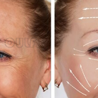 �����ߵ��ÿ�����ȫ���ס��ߵ��沿����Ҫ��ûָ���Ȼ��̫����