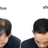 ֲ��֮������Ҫע�����ֲ����������Ҫ��Ϣ��á��úڰ�~