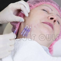 �������ߵ�һ�㼸��ָ����ߵ���������ſ��Իָ���