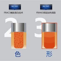 ŷ��֮����ʲô������Ŀ��ŷ��֮���ʺ϶��������