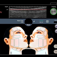 �����������һ�Σ���������ά�ֶ೤ʱ��~