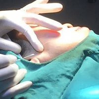 �ߵ���ά�ֶ�������ߵ�֮��Ҫע��ʲô~