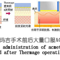 ���꼪�����Ч�������꼪4����һ����ά�ֶ೤ʱ��