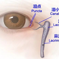 Ϊʲô�ε�����ҩˮ�����ȴ��ɤ�ӣ�