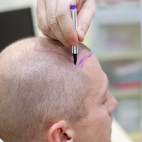 ֲ����ҹ��Ӱ��ֲ��Ч����ֲ�����ʲô������ͷ������