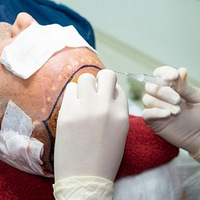 ��ֲͷ��������ô������ֲ��֮������Ҫע����𡢱�ѧ�ı�������