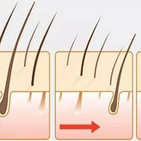 ֲ������ë�ҲŻ��ȹ̣�Ϊʲôֲ��ֻ��ά��������~