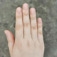 8����ָͷ�׳���8�����ܲ���ҽ��С�������ǽ�һ����