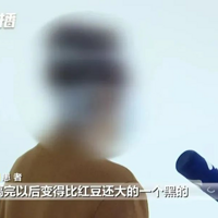 Ů�ӱ�ͷ������һֱ��Ϊ�Ǻ�ͷ��ҽ��һ�����ǰ�֢��