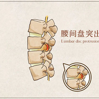 ׳�����˻����ⲡ������6�꣬��㱣��ס��