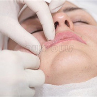 ������̸������΢������Ч���ò��á�΢������ά�ֶ��~