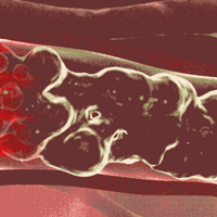 ȫ���˿�ͻ��80�ڣ��м��أ��غ�ʮ�����ظ�����