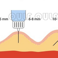 ����֬���������ס�֬��������ô�����ܱ�֤�ɻ���