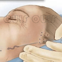 ����΢����Ҫ�����ͷ�ף���΢������ûָ���~