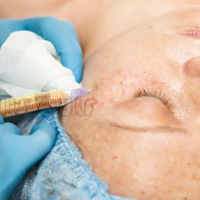 �����ʣ�֬�������Ӳ��������֬��������Ӳ������ô�졢