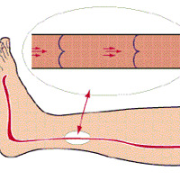 ���������ס��ء�Ѫ˨�ĵط�������ʱ��2���ź�������