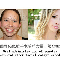 �ߵ�������������ά�ֶ�á��ߵ��沿�����ܱ��ֶ೤ʱ�䡢�����