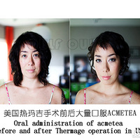 ���꼪������ʲô�˺������꼪����֢�ж����ء�̫����~