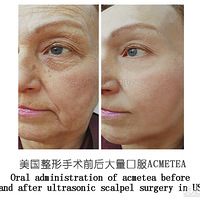 �����ڵĻָ����Ƕ�á������ڵڶ��컯ױ�ˡ�̫���˰�~