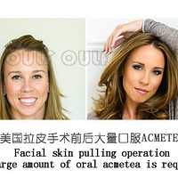 ��Ƥ���������ȫ���ס�����Ƥ������ÿ�����ȫ�ָ��������е���