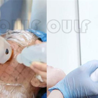 ���꼪��ʲôԭ�������꼪�����Ƥ������ɳ���