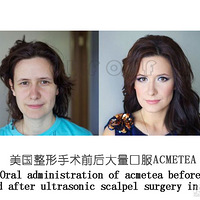 ����գ��޺۽�Ĥ������ʲô�������޺۽�Ĥ�������ʺ϶�������