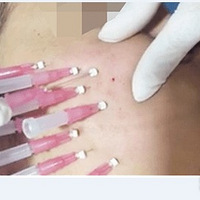 �ߵ�20�������఼���ָܻ�ô���ߵ�͹��ƽ��ûָ�~