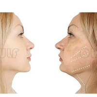 7d����������Ч��ͼ��7d�����������þ�����Ч��~