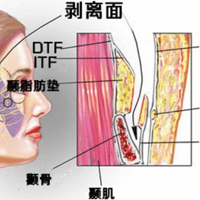 ������Ƥ������Լ����Ǯ��������Ƥ������Ҫ����Ǯ��