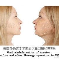 ��˵���꼪4����5�����������꼪�Ĺ�Ч�빦�ܡ�����ã~