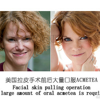 ���ġ�������Ƥ�����᲻���к���֢����Ƥ�����հ��ݶ������ʧ