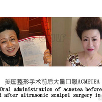 ʲô��΢��������������΢������ż۸��Ƕ��١�ǧ��𱻺�����~