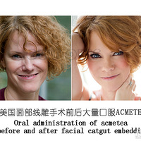 ���ģ������ߵ������а��ݶ�û�ָ����沿�ߵ�ָ��ڶ��~