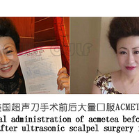 �Ȱȣ����������ݶ����һ�Ρ���һ�γ���������ά�ֶ��~