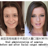 ����������һ������Ǯ��ȫ���ߵ�һ�����Ǯ�����齲��~