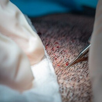 ֲ�������ں��ÿ�ʼ������ֲ��Ч���ܱ��ֶ��~