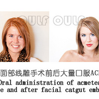 �沿�ߵ�ĸ����ú�Σ�����ߵ�����Ͷ�ûָ��á�̫������~