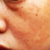 ˮ�����Ƥ�����˺��� ˮ������û�и����ú�Σ��