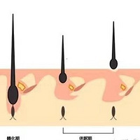 ֲ��ǰ��Ҫע��ʲô��ֲ�������Ӱ�����~